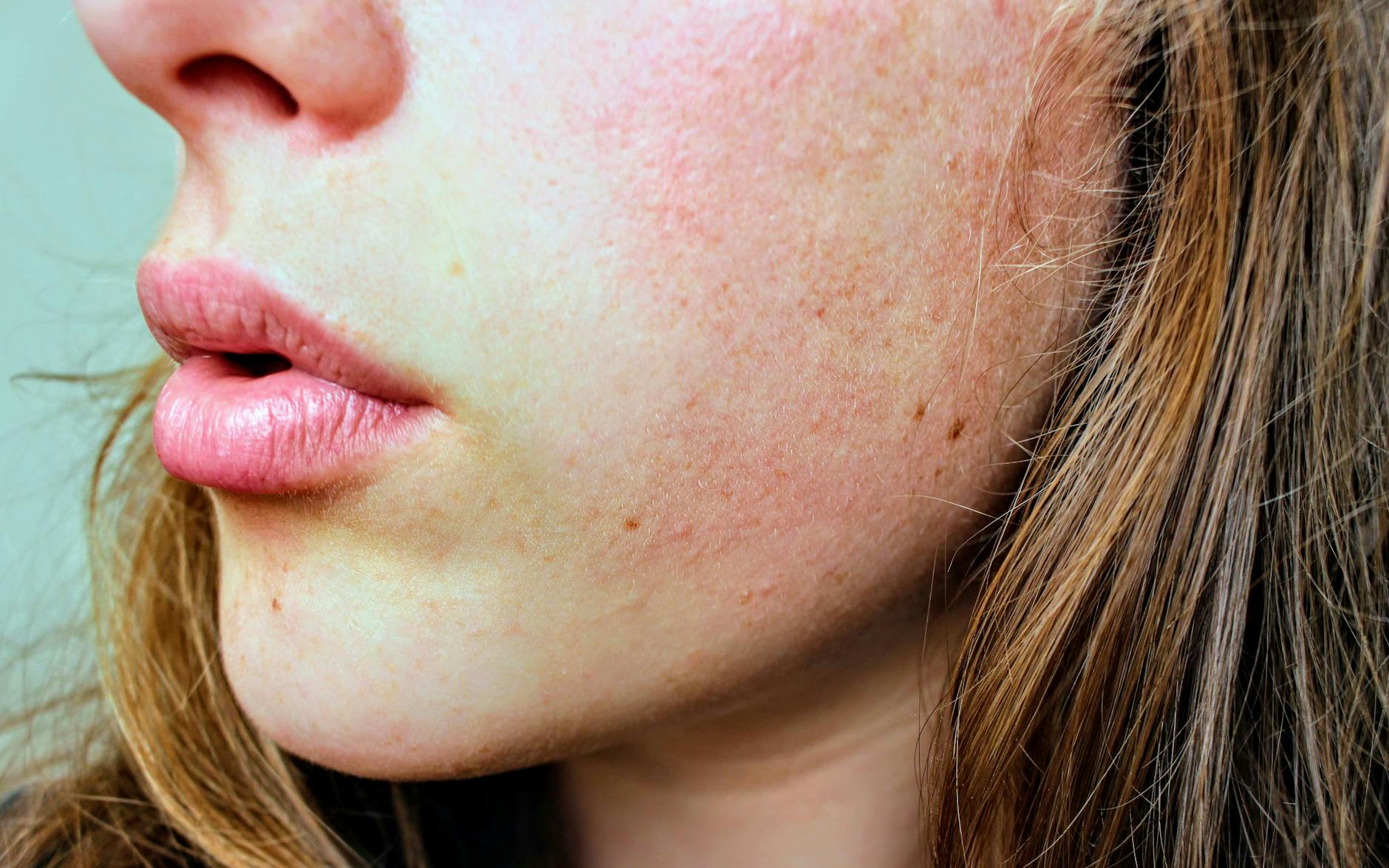 Close-up of natural facial skin showing healthy texture and complexion, illustrating skin quality